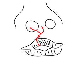 Хирургия губы и коррекция положения носа | Расщепление губы и нёба